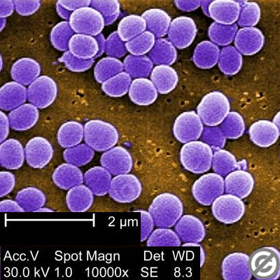 http://www.kimicontrol.com/microorg/staphylococcus%20aureus.jpg